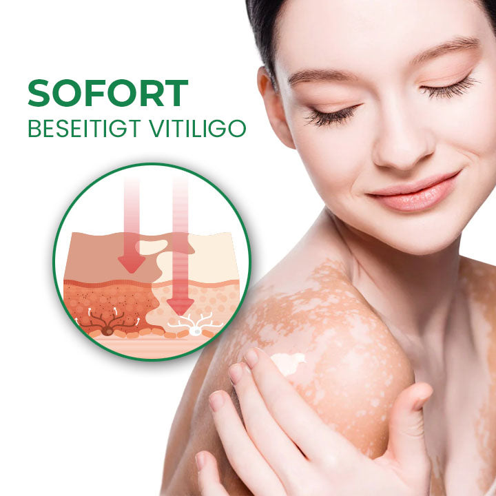 Oveallgo™ VitiligoFix X Revitalisierendes Elixier