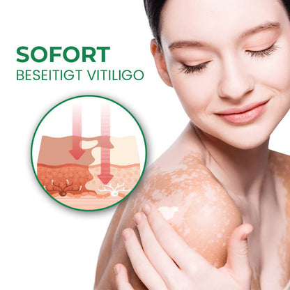 Oveallgo™ VitiligoFix X Revitalisierendes Elixier