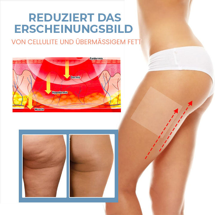 Oveallgo™ Ultimativ Zelle Straffen Anti-Cellulite Kollagen-Straffungspflaster