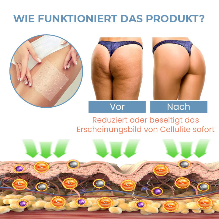 Oveallgo™ Ultimativ Zelle Straffen Anti-Cellulite Kollagen-Straffungspflaster