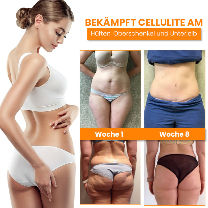 Oveallgo™ BEAUTIFIC Profi AntiCellulite Straffende Seife