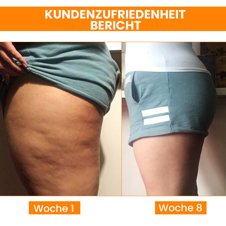 Oveallgo™ BEAUTIFIC Profi AntiCellulite Straffende Seife