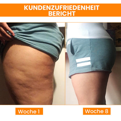 Oveallgo™ BEAUTIFIC Profi AntiCellulite Straffende Seife