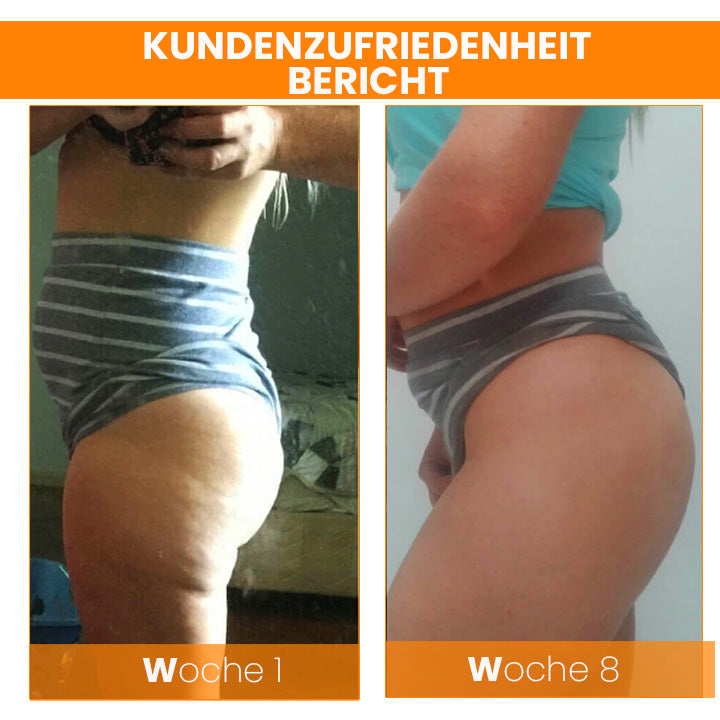 Oveallgo™ BEAUTIFIC Profi AntiCellulite Straffende Seife