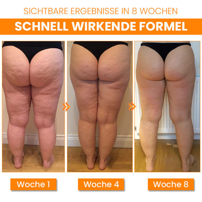 Oveallgo™ BEAUTIFIC PURE AntiCellulite Straffende Seife