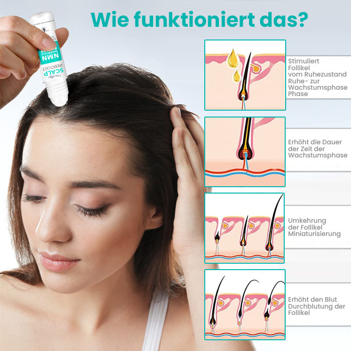 Oveallgo™ ScalpReboost NMN Haarwuchs Roller