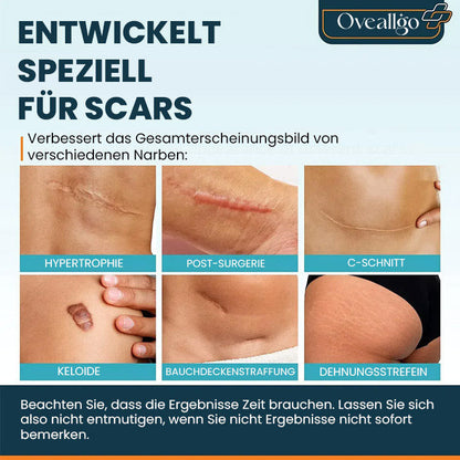 Oveallgo™ ScarAway Ultimativ Fortschrittliches Narbengel