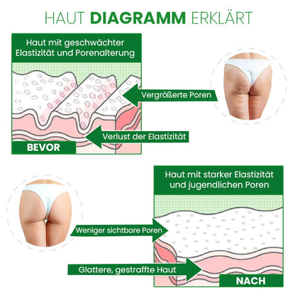 SusoSkin Profi 2-in-1-Kräuterbalsam zur Beruhigung von Cellulite