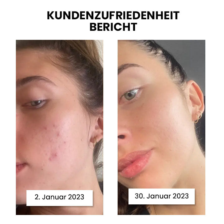 Thiccfitts™ Deluxe Silk Anti-Acne Kopfkissenbezug