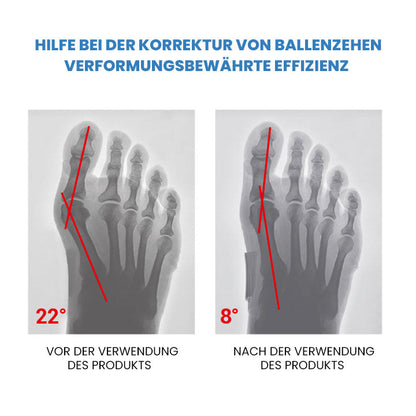 Wingle Profi Anti-Bunions Gesundheitssocke