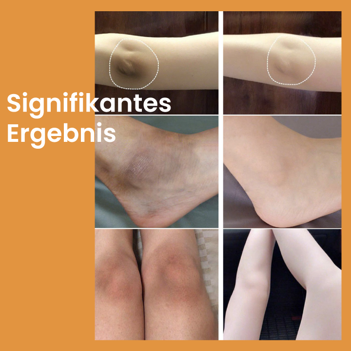 Oveallgo™ Korean Acid+ Peeling-Öl zur Aufhellung der Haut