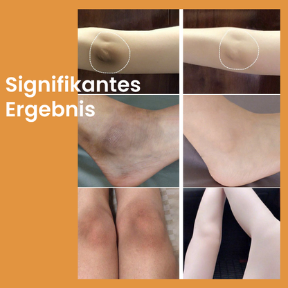 Oveallgo™ Korean Acid+ Peeling-Öl zur Aufhellung der Haut
